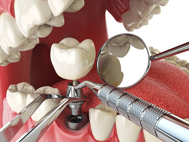 Best Urgent Tooth Repair  in Levelland, TX